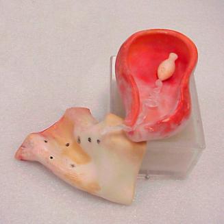 EMBRYO'S DREAM PLACE